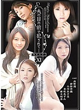 ATKD-174 DVD封面图片 