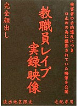 XBIV-001 DVD Cover